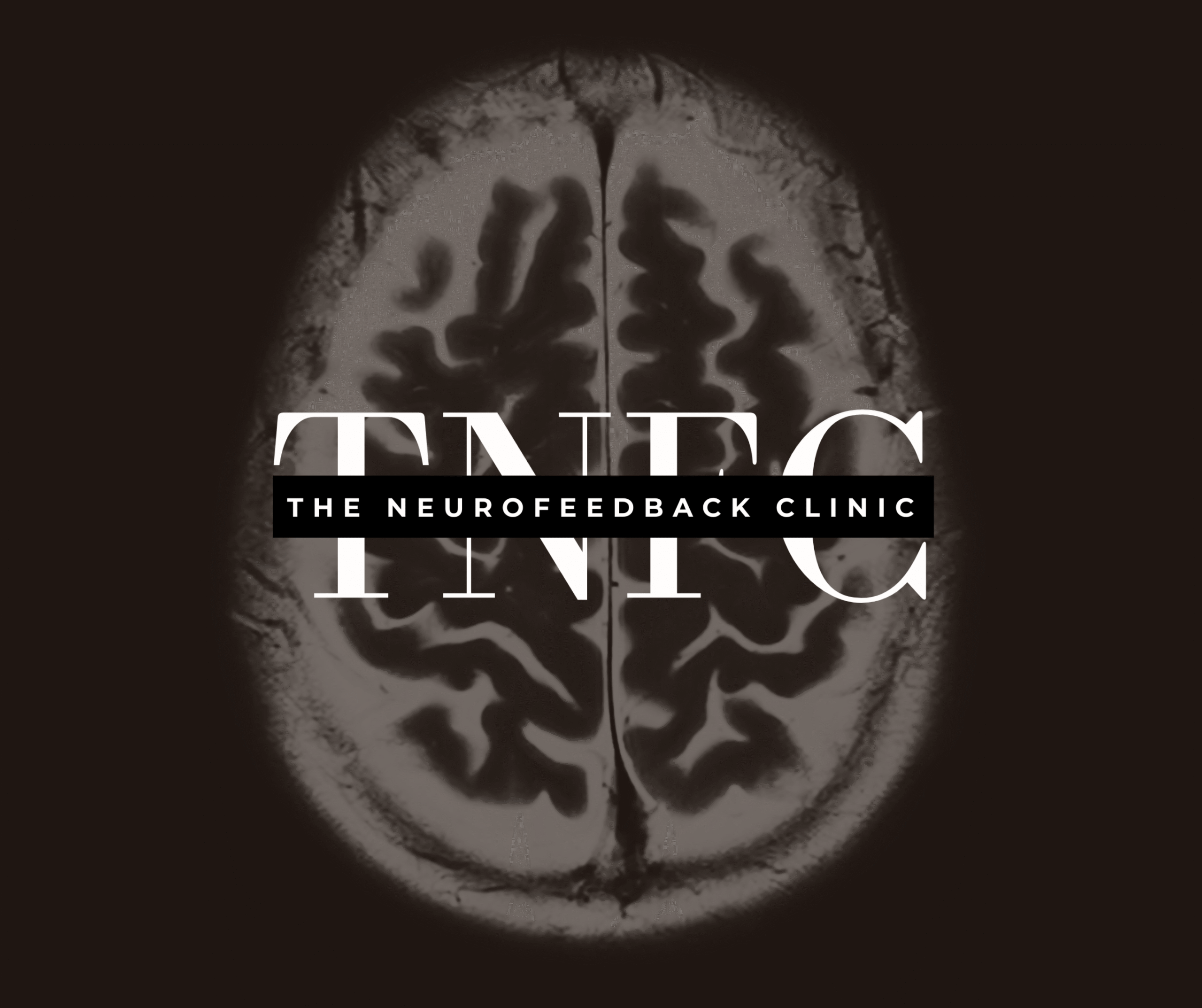 An MRI brain scan in black and white with TNFC in large white letters and The Neurofeedback Clinic written in smaller text across the center.